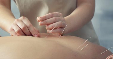 Young man getting acupuncture treatment, closeup